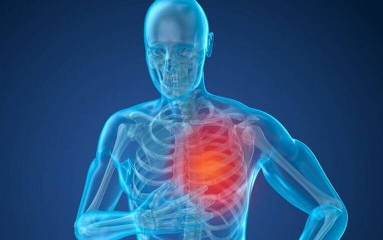 Hipertensión Arterial Pulmonar es silenciosa y peligrosa.